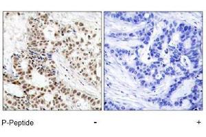Image no. 1 for anti-Breast Cancer 1 (BRCA1) (pSer1423) antibody (ABIN196995) (BRCA1 抗体  (pSer1423))