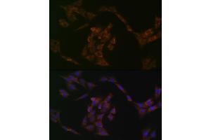 Immunofluorescence analysis of C6 cells using IRF6 Rabbit mAb (ABIN1680921, ABIN3017588, ABIN3017589 and ABIN7101507) at dilution of 1:100 (40x lens). (IRF6 抗体)