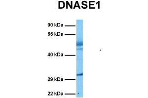 Host:  Rabbit  Target Name:  DNASE1  Sample Tissue:  Human Lung Tumor  Antibody Dilution:  1. (DNASE1 抗体  (N-Term))