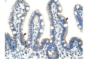 Fibrillarin antibody was used for immunohistochemistry at a concentration of 4-8 ug/ml to stain Epithelial cells of intestinal villus (arrows) in Human Intestine. (Fibrillarin 抗体  (N-Term))