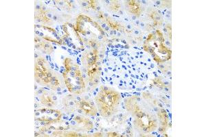 Immunohistochemistry of paraffin-embedded mouse kidney using MOK antibody. (MOK 抗体)