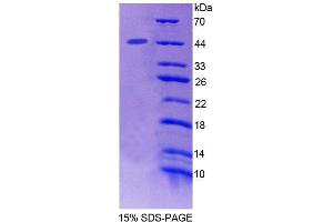 SDS-PAGE analysis of Mouse STAM2 Protein. (STAM2 蛋白)