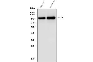 Western blot analysis of PDE6 alpha/PDE6A using anti-PDE6 alpha/PDE6A antibody (ABIN7599710).