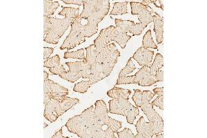 (ABIN392786 and ABIN2842224) staining PFKFB4 in human skeletal muscle tissue sections by Immunohistochemistry (IHC-P - paraformaldehyde-fixed, paraffin-embedded sections). (PFKFB4 抗体  (AA 266-296))