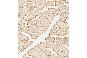(ABIN392786 and ABIN2842224) staining PFKFB4 in human skeletal muscle tissue sections by Immunohistochemistry (IHC-P - paraformaldehyde-fixed, paraffin-embedded sections). (PFKFB4 抗体  (AA 266-296))
