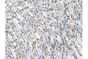 ABIN6255315 and ABIN6267100 at 1/100 staining Rat stomach tissue by IHC-P.