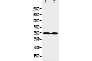 Anti-CCR3 antibody, Western blotting Lane 1: K562 Cell Lysate Lane 2: RAJI Cell Lysate (CCR3 抗体  (N-Term))