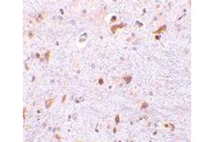Immunohistochemistry of PDCD4 in mouse brain tissue with PDCD4 polyclonal antibody  at 2. (PDCD4 抗体  (C-Term))