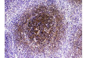 Immunohistochemistry (IHC) image for anti-Cytotoxic T-Lymphocyte-Associated Protein 4 (CTLA4) (AA 36-161) antibody (ABIN5518903)