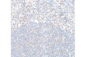 Immunohistochemistry (IHC) image for anti-Nucleoprotein TPR (TPR) (C-Term) antibody (ABIN7448922) (TPR 抗体  (C-Term))
