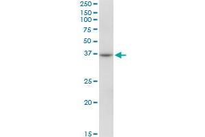 RHOXF2 MaxPab polyclonal antibody. (RHOXF2 抗体  (AA 1-288))