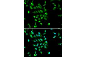 Immunofluorescence analysis of MCF7 cell using PSMC5 antibody. (PSMC5 抗体  (AA 127-406))