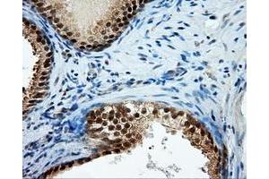 Immunohistochemical staining of paraffin-embedded Kidney tissue using anti-TPMT mouse monoclonal antibody. (TPMT 抗体)