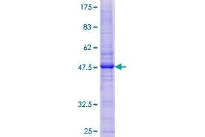 Caveolin 2 Protein (CAV2) (AA 1-162) (GST tag)