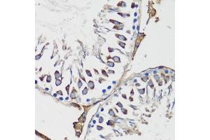 Immunohistochemistry of paraffin-embedded rat testis using Cyclin B1 antibody (ABIN7266555) at dilution of 1:100 (40x lens).