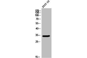 Western Blot analysis of 293T-UV cells using Olfactory receptor 5W2 Polyclonal Antibody (OR5W2 抗体  (Internal Region))
