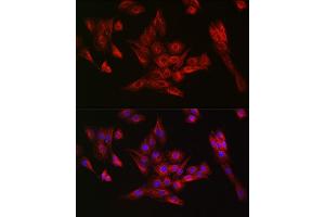 Immunofluorescence (IF) image for anti-Tubulin, alpha 4a (TUBA4A) antibody (ABIN7271036)