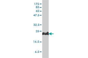 PRDX1 monoclonal antibody (M01), clone 4B11-D10 Western Blot analysis of PRDX1 expression in HeLa . (Peroxiredoxin 1 抗体  (AA 1-199))