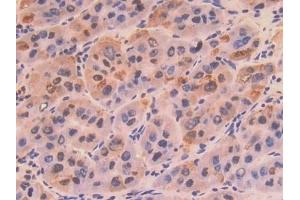 Immunohistochemistry (IHC) image for anti-Collagen, Type VIII, alpha 1 (COL8A1) (AA 575-743) antibody (ABIN7434713)
