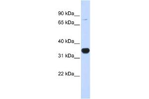 Western Blotting (WB) image for anti-Ras Homolog Gene Family, Member T1 (RHOT1) (N-Term) antibody (ABIN405704)