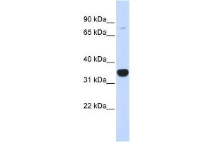WB Suggested Anti-RHOT1 Antibody Titration:  0. (RHOT1 抗体  (N-Term))