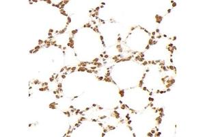 Immunohistochemistry (Paraffin-embedded Sections) (IHC (p)) image for anti-Glutathione S-Transferase theta 1 (GSTT1) antibody (ABIN7074091)