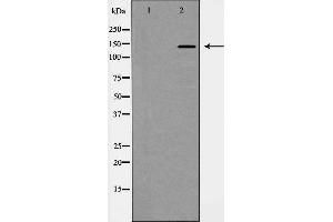 Western blot analysis of PDGFR α expression in HepG2 cells. (PDGFRA 抗体  (C-Term))