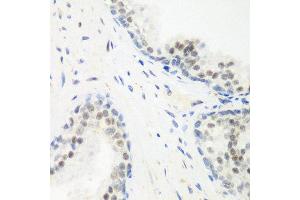 Immunohistochemistry of paraffin-embedded human prostate using PPAN antibody at dilution of 1:200 (40x lens). (PPAN 抗体)