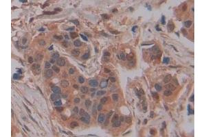 Immunohistochemistry (IHC) image for anti-Glutathione S-Transferase mu 4 (GSTM4) (AA 18-215) antibody (ABIN7439909)