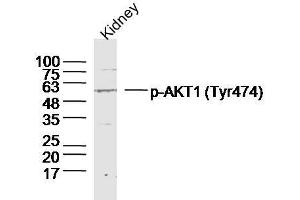 Mouse kidney lysates probed with AKT1/2/3 (Tyr474) Polyclonal Antibody, unconjugated  at 1:300 overnight at 4°C followed by a conjugated secondary antibody at 1:10000 for 90 minutes at 37°C. (AKT 1/2/3 抗体  (pTyr474))