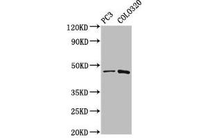 Western Blot Positive WB detected in: PC-3 whole cell lysate, Colo320 whole cell lysate All lanes: CAPS2 antibody at 5. (Calcyphosine 2 抗体  (AA 191-274))