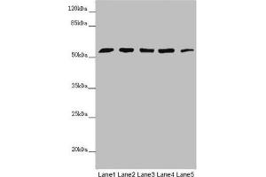 Western blot All lanes: CEP57L1 antibody at 6. (CEP57L1 抗体  (AA 1-167))