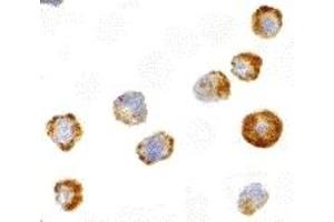 Immunohistochemistry (IHC) image for anti-Mitogen-Activated Protein Kinase Kinase Kinase 5 (MAP3K5) antibody (ABIN1030199) (ASK1 抗体)
