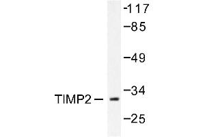 Image no. 1 for anti-Metalloproteinase Inhibitor 2 (TIMP2) antibody (ABIN271854) (TIMP2 抗体)