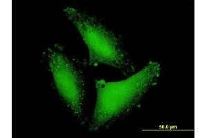 Immunofluorescence of purified MaxPab antibody to DCP2 on HepG2 cell. (DCP2 抗体  (AA 1-385))