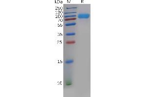 SDS-PAGE (SDS) image for CD276 (CD276) (AA 29-245) protein (mFc-His Tag) (ABIN6961085)