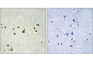 Immunohistochemistry analysis of paraffin-embedded human brain, using ANKRD26 Antibody. (ANKRD26 抗体  (AA 791-840))