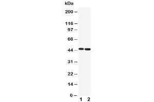 Western blot testing of 5HT1A Receptor antibody and Lane 1:  rat brain (Serotonin Receptor 1A 抗体  (C-Term))