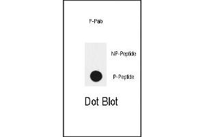 Dot blot analysis of anti-EGFR-p Phospho-specific Pab (ABIN389792 and ABIN2839693) on nitrocellulose membrane. (EGFR 抗体  (pTyr1172))