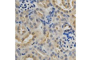 Immunohistochemistry of paraffin-embedded mouse kidney using MAPK10 antibody at dilution of 1:200 (x400 lens) (MAPK10 抗体)
