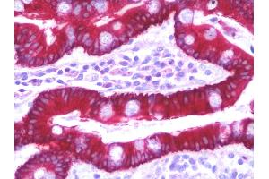 Immunohistochemistry (IHC) image for anti-Solute Carrier Family 35 (UDP-GlcNAc/UDP-Glucose Transporter), Member D2 (SLC35D2) (C-Term) antibody (ABIN1935979)