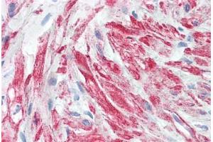 Human Prostate, Stroma: Formalin-Fixed, Paraffin-Embedded (FFPE)