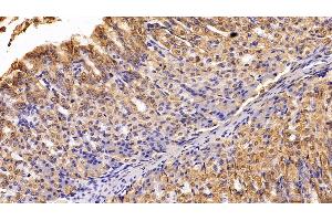 Immunohistochemistry (IHC) image for anti-Keratin 19 (KRT19) (AA 1-403) antibody (ABIN7436894)