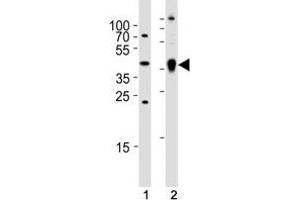 Western blot analysis of (1) zebrafish brain and (2) whole zebrafish tissue lysate using Ada antibody. (ADA 抗体  (AA 114-148))