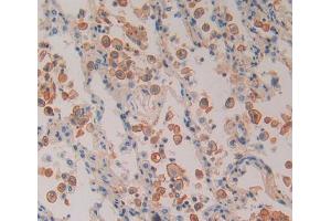 Used in DAB staining on fromalin fixed paraffin- embedded Kidney tissue (PSMD5 抗体  (AA 143-341))