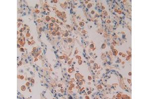 Used in DAB staining on fromalin fixed paraffin- embedded Kidney tissue (Proteasome 26S Subunit, Non ATPase 5 (AA 143-341) 抗体)
