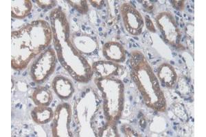 DAB staining on IHC-P; Samples: Human Kidney Tissue) (GOT1 抗体  (AA 1-413))