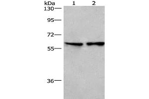 Western Blot analysis of Lovo cell and Mouse lung tissue using CD244 Polyclonal Antibody at dilution of 1:526 (2B4 抗体)
