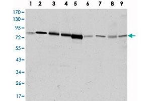 Western blot analysis using ADRBK1 monoclonal antibody, clone 3F8  against HeLa (1), Jurkat (2), MOLT 4 (3), Raji (4), THP-1 (5), L1210 (6), COS-7 (7), PC-12 (8), and NIH/3T3 (9) cell lysate. (GRK2 抗体)