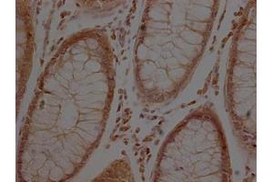 Immunohistochemistry (IHC) image for anti-Actin, beta (ACTB) (AA 1-50) antibody (ABIN7127368)